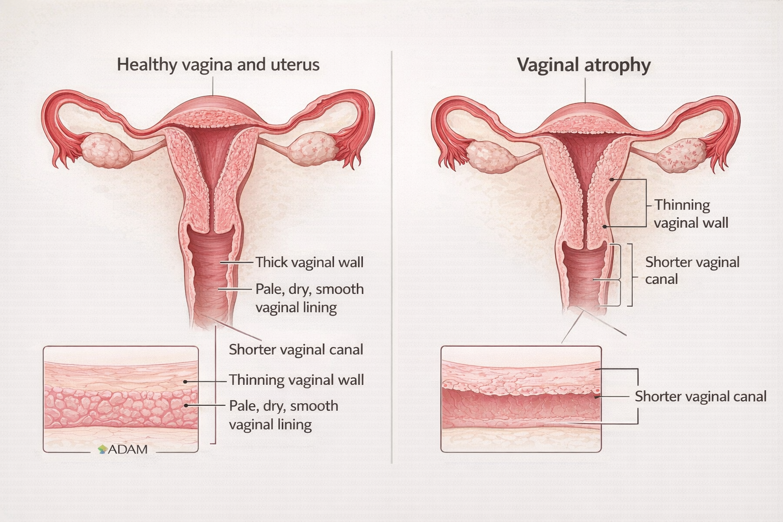 Gynecologist explaining laser women